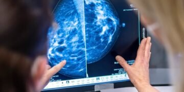 Cancer du sein la Fondation salue lélargissement du dépistage mais réclame une approche personnalisée - Quebecoscope - L'Actualité Montréalaise 🎗️ La Fondation cancer du sein du Québec appuie l’élargissement du dépistage, mais réclame une approche personnalisée basée sur le risque individuel. #CancerDuSein #SantéQuébec