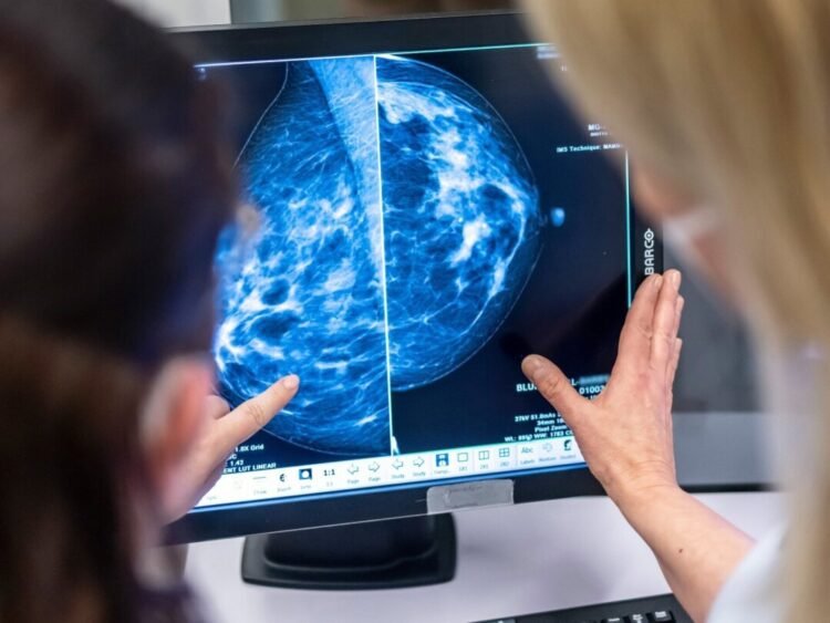 🎗️ La Fondation cancer du sein du Québec appuie l’élargissement du dépistage, mais réclame une approche personnalisée basée sur le risque individuel. #CancerDuSein #SantéQuébec